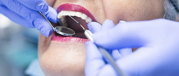 Best Knocked-Out Tooth (Avulsed Tooth) Treatment in Maple Valley, WA